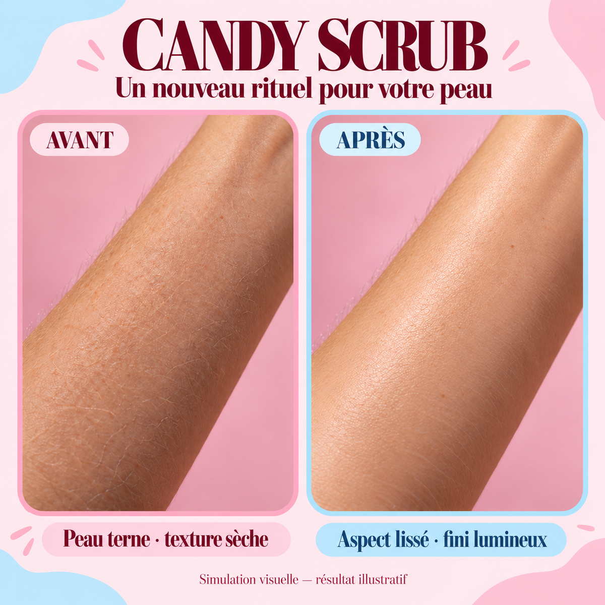 Candy Scrub avant / après : simulation visuelle, résultat illustratif